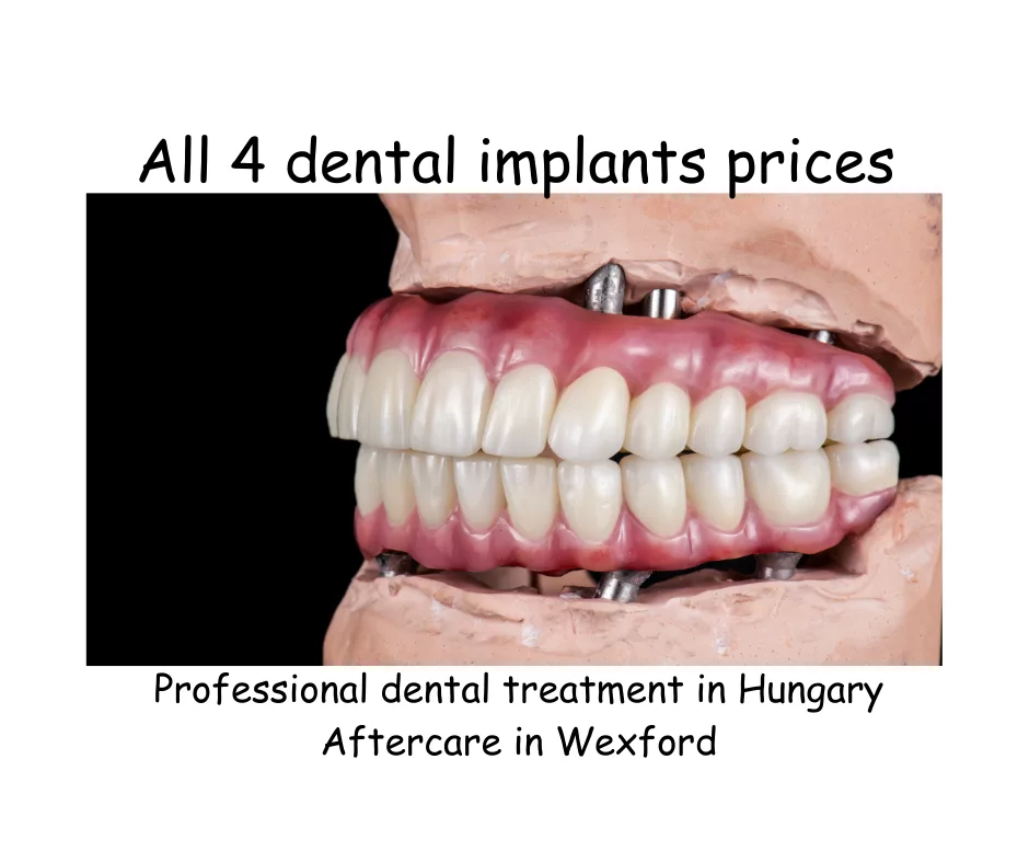 All 4 dental implants prices image 2