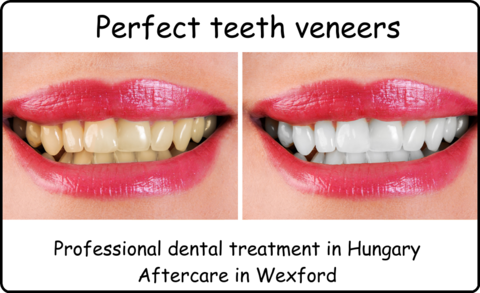 Perfect teeth veeners image 2 female