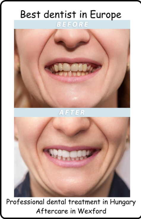 Professional dental treatment in Hungary aftercare in Wexford image