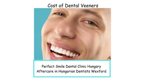 Cost of dental veeners image