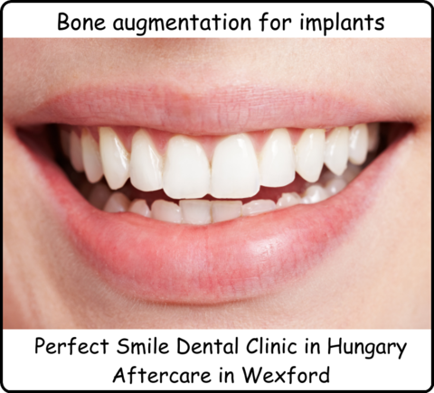 Bone augmentation for implants image