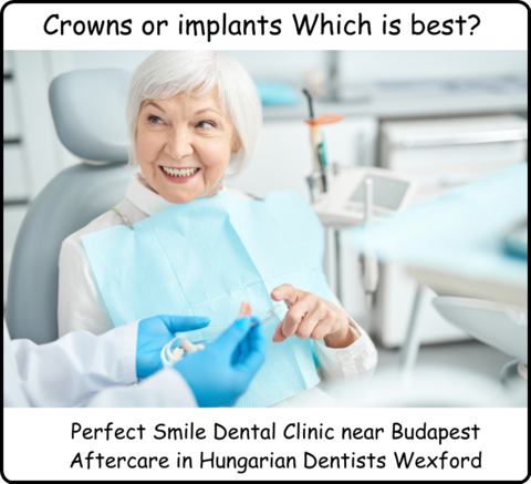 Crowns or implants which is best image