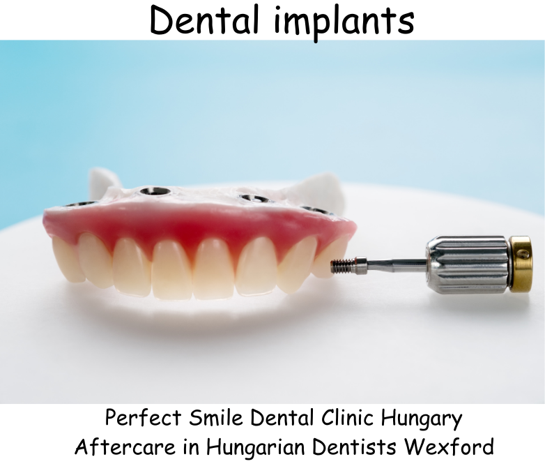 Dental implants image