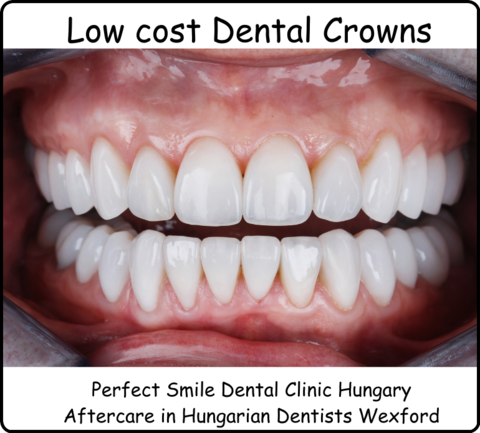 Low cost dental crowns in Hungary image