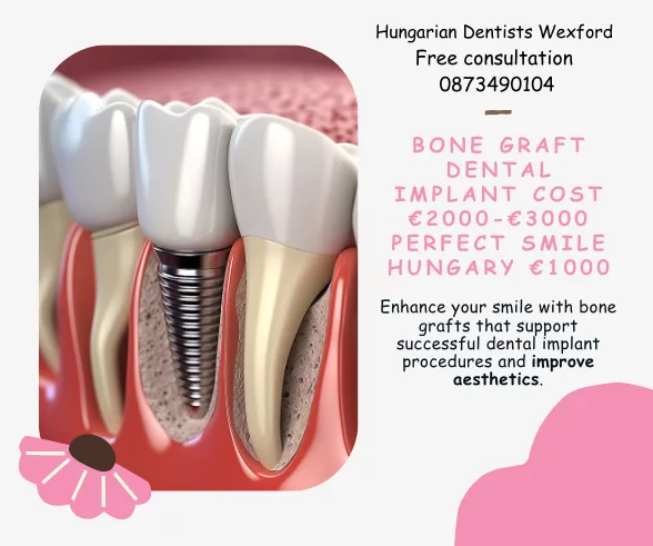 Bone graft dental implant cost image