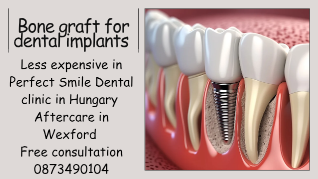 Bone graft for dental implants Perfect Smile dental clinic in Hungary image