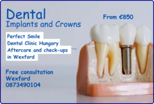 Dental implants and crowns image