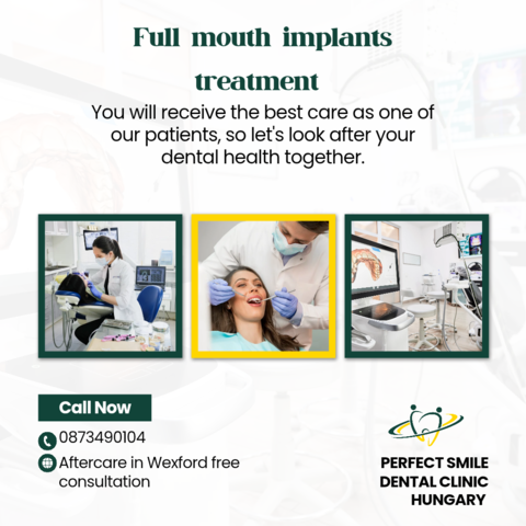 Full mouth implants treatment image