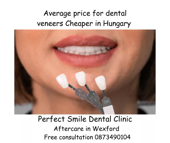 Average price for dental veneers image