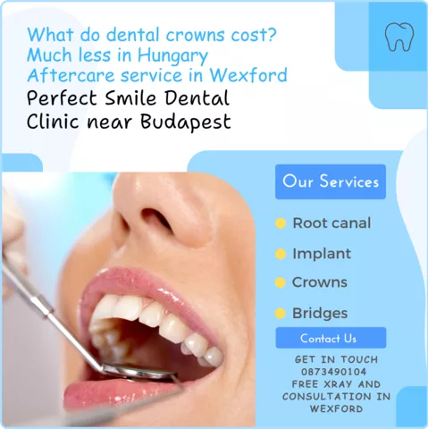 What do dental crowns cost image