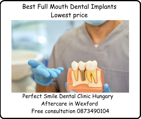 Best full mouth dental implants image
