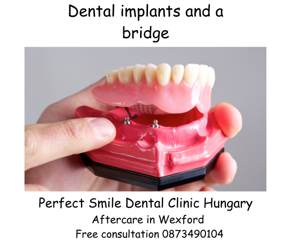 Dental implants and a bridge image
