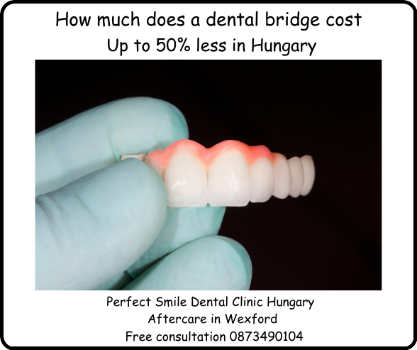 How Much does a dental bridge cost image