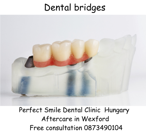 Dental bridges Perfect Smile dental clinic Hungary image 