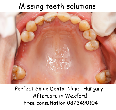 Missing teeth solutions image