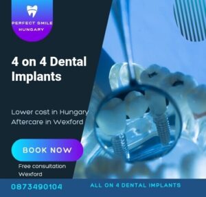 4 on 4 dental implants image