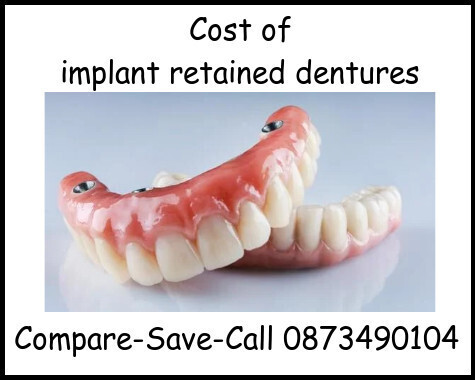 Cost of implant retained dentures image
