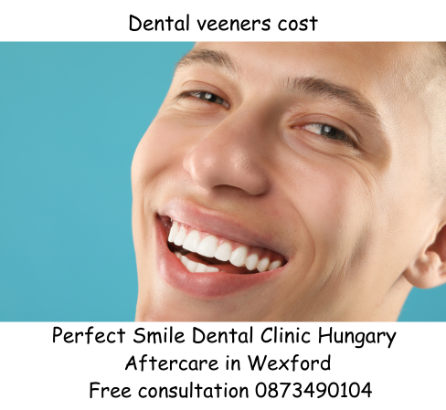 Dental veeners cost image