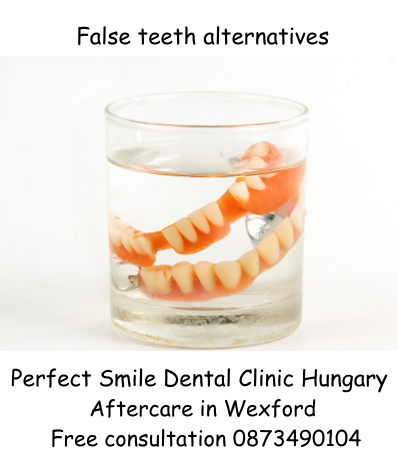 False teeth alternatives image