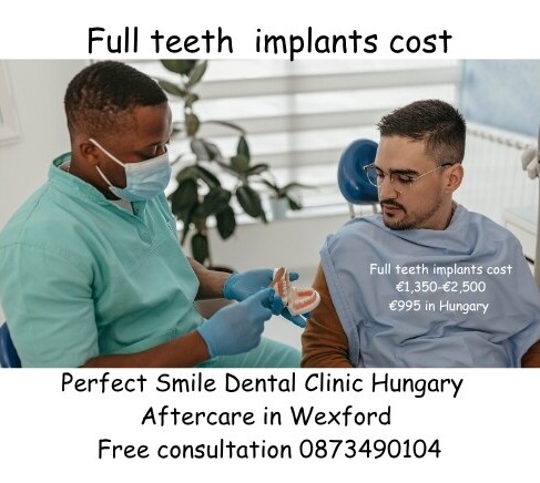 Full teeth implants cost image
