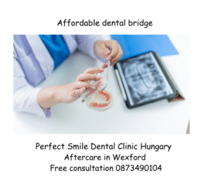 Affordable dental bridge image