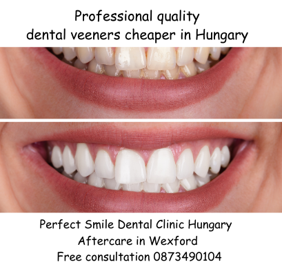 Professional quality dental veeners Perfect Smile dental clinic Hungary image