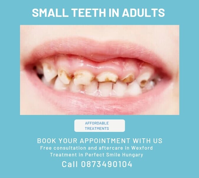 Small teeth in adults image