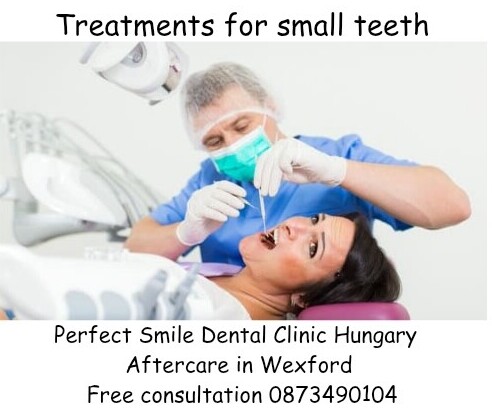 Treatments for adult small teeth image