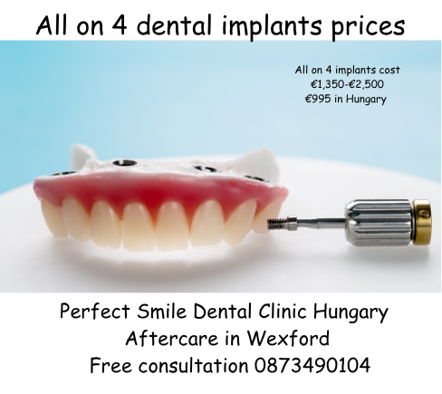 All on 4 dental implants prices image