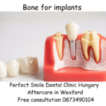 Bone for implants image