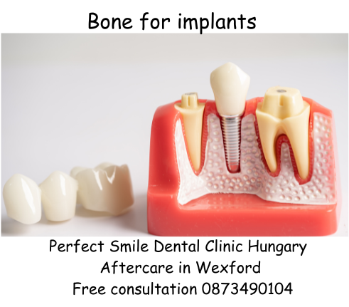 Bone for implants image