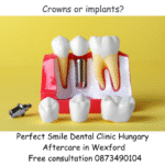 Crowns or implants? Image