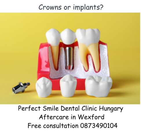 Crowns or implants? Image