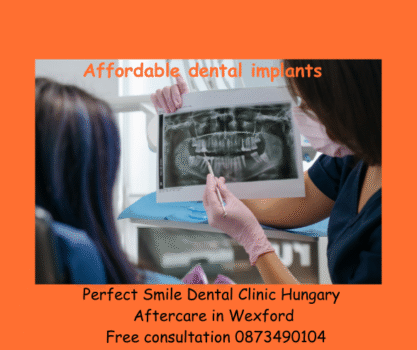 Affordable dental implants image