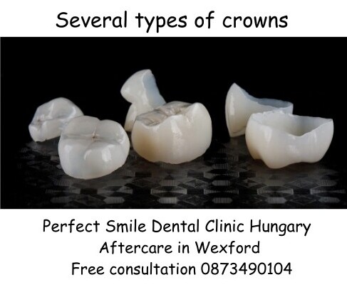 Several types of crowns image