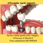 Affordable teeth implants image
