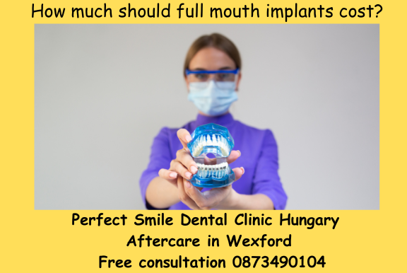 How much should full mouth implants cost.? Image