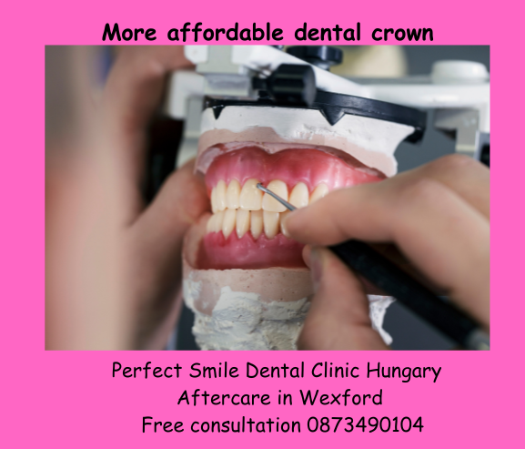 More affordable dental crown Perfect Smile dental clinic Hungary image