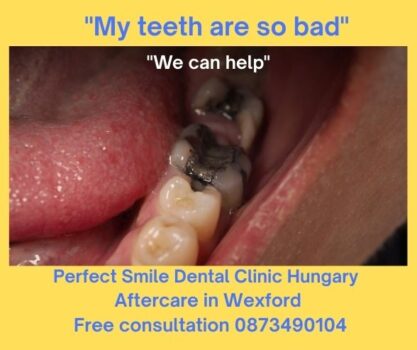 My teeth are so bad image 