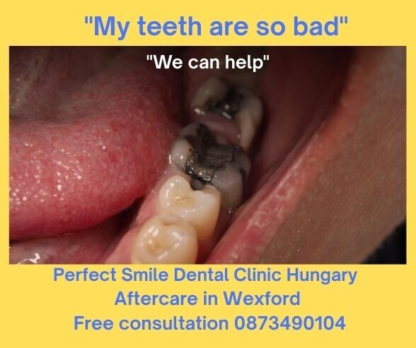 My teeth are so bad image