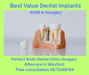 Best value dental implants image