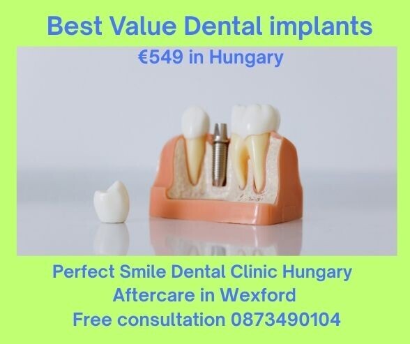 Feature image Best value dental implants image
