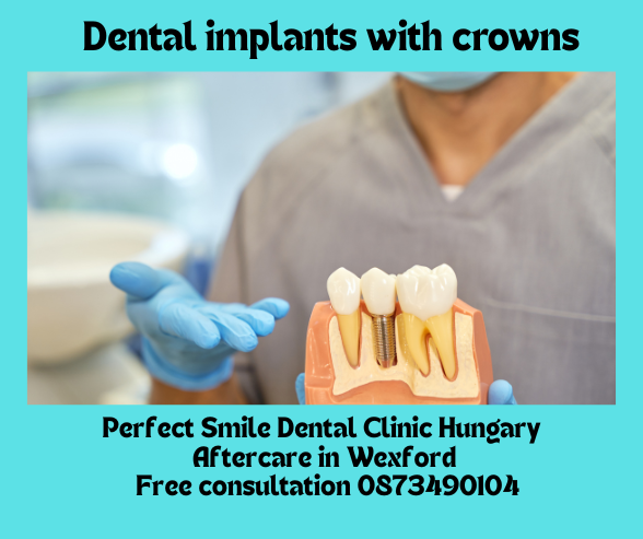 Dental implants with crowns image