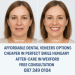Affordable dental veneers options image