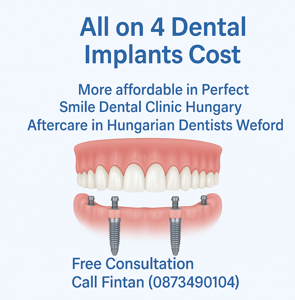 All on 4 dental implants cost image