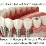 Much does a full set teeth implants cost image