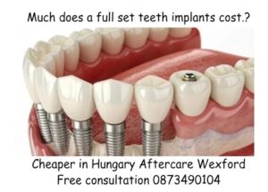 Much does a full set teeth implants cost image