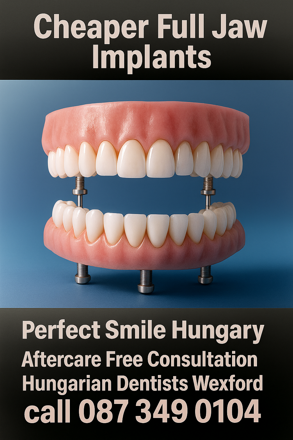 Full Jaw Implants – A Complete Solution For Missing Teeth