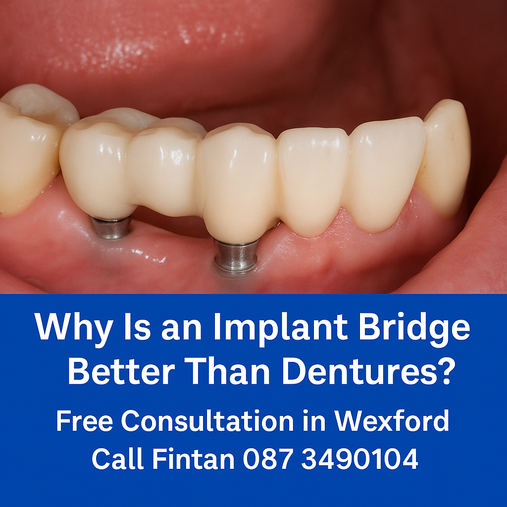 Why Is an Implant Bridge Better Than Dentures? Read the facts and reasons why