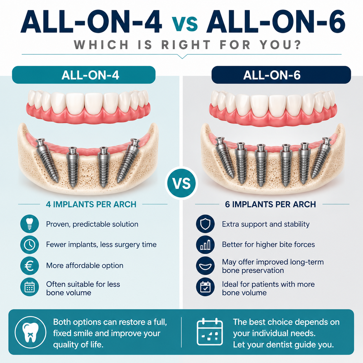 All-on-4 versus All-on-6 dental implants comparison